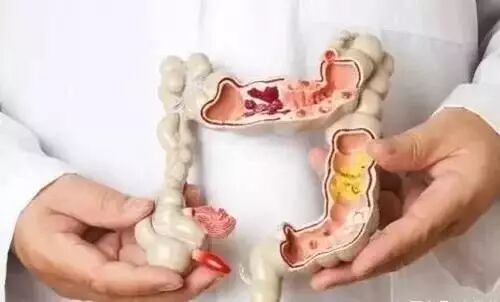 空腹喝 “安化黑茶”，竟可以帮你排出4公斤的陈年宿便，很有效