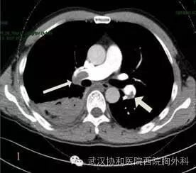 胸痛究竟看哪个科