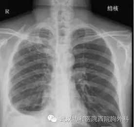 胸痛究竟看哪个科