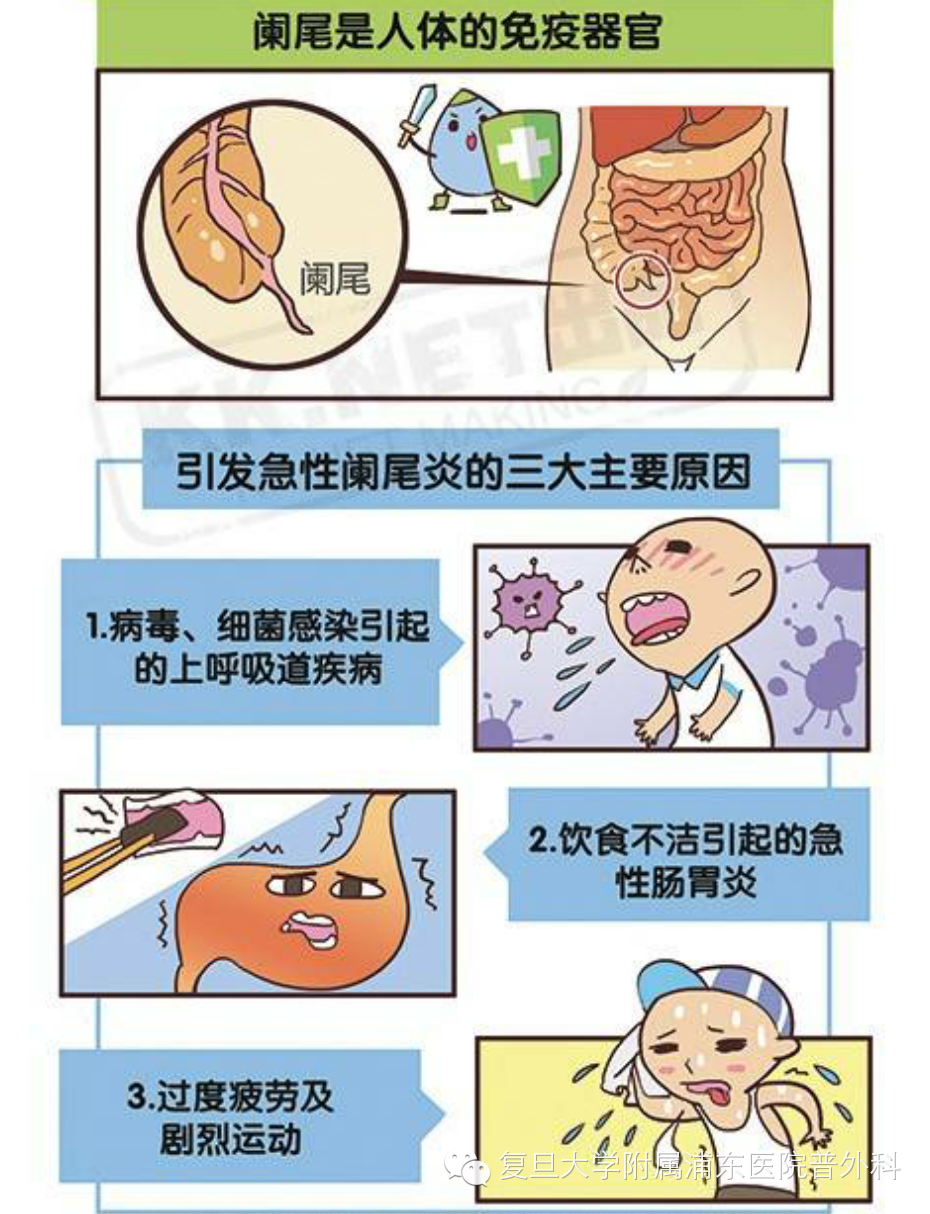 末端突出的具有盲端管状结构,是从盲肠长出来的,盲肠炎是盲肠的炎症