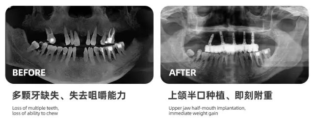 【愛牙日•口腔健康 全身健康】海德堡聯合口腔攜手天津廣播電視臺守護市民口腔健康 健康 第14張