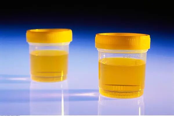 脸上,手上,嘴里都有!