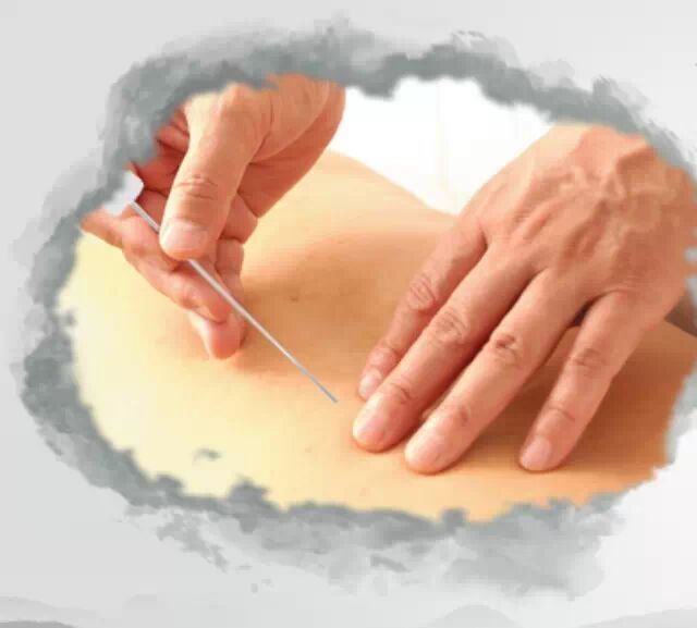 小针刀微创疗法介绍