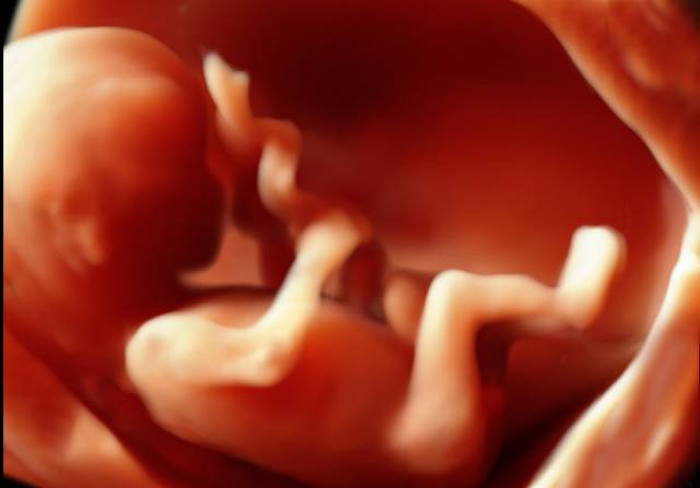 VOlusonE什么彩超机「升级」“金标版”GE Voluson E10四维彩超——从高清到高精，每一帧都是爱与期待的模样_https://www.jmylbn.com_新闻资讯_第5张