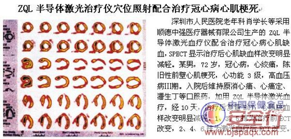 光子治疗仪有什么效果心脏的保护神——洫通光子冠心病治疗仪_https://www.jmylbn.com_新闻资讯_第38张