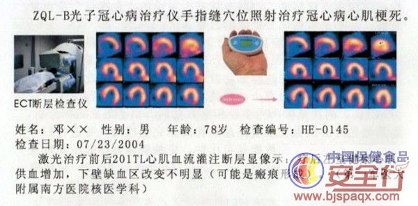 光子治疗仪有什么效果心脏的保护神——洫通光子冠心病治疗仪_https://www.jmylbn.com_新闻资讯_第40张