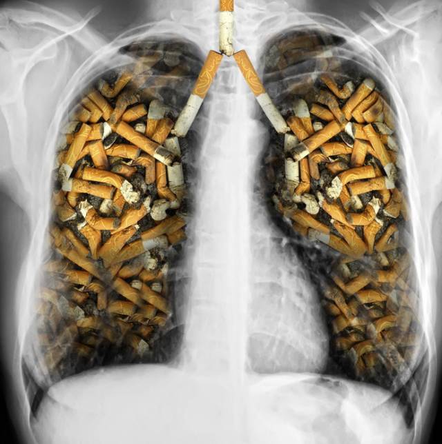 十年吸烟的肺图片图片