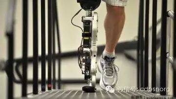 肢体器材有哪些【康复辅具百科（三）】：肢体残疾康复训练的常用辅具有哪些？_https://www.jmylbn.com_新闻资讯_第6张