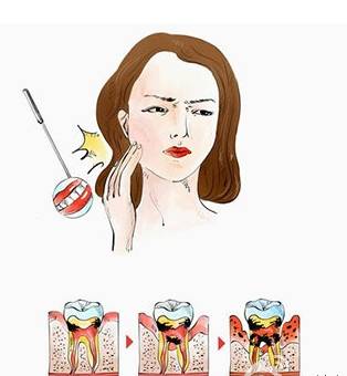 及时补牙其实能帮你省很多钱哦～