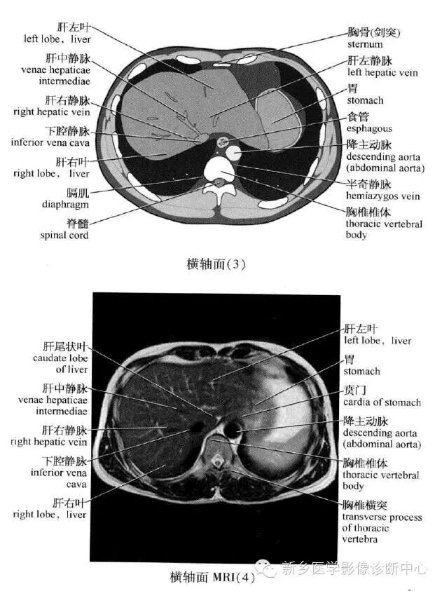 史上最全腹部横断位解剖详细标注