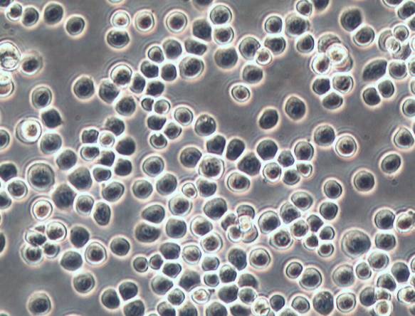 昆虫细胞悬浮培养形态