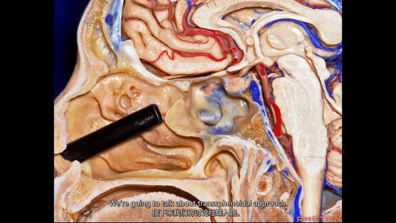 经典回顾rhoton系列解剖视频anteriorskullbasepart1前颅底下集