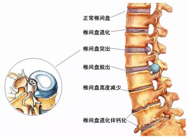 腰椎位置图片图片