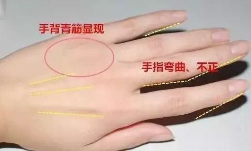 左手权，右手财，万里挑一的手相！