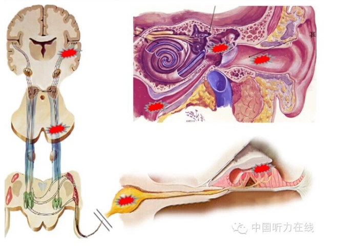 听神经 www.haodf.com