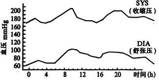 清晨最容易发生心梗、脑梗和脑出血！
