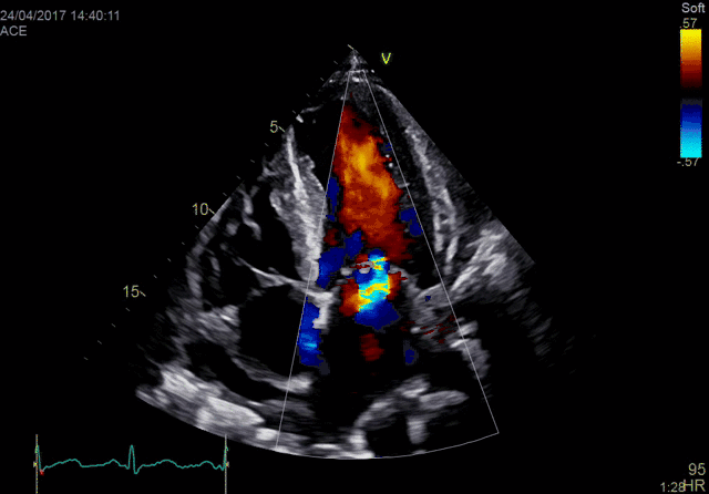 ge探头频率有哪些分享｜GE vivid E90高端心脏超声／二维心血管超声诊断系统及探头配置_https://www.jmylbn.com_新闻资讯_第4张
