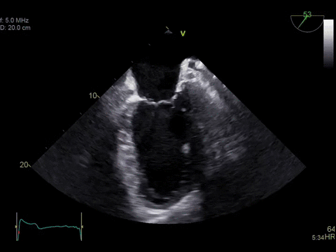 ge探头频率有哪些分享｜GE vivid E90高端心脏超声／二维心血管超声诊断系统及探头配置_https://www.jmylbn.com_新闻资讯_第5张