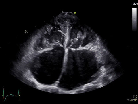 ge探头频率有哪些分享｜GE vivid E90高端心脏超声／二维心血管超声诊断系统及探头配置_https://www.jmylbn.com_新闻资讯_第3张
