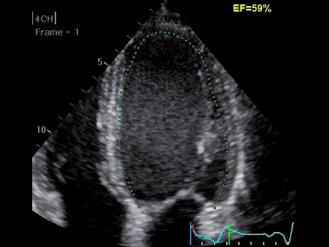 ge探头频率有哪些分享｜GE vivid E90高端心脏超声／二维心血管超声诊断系统及探头配置_https://www.jmylbn.com_新闻资讯_第6张