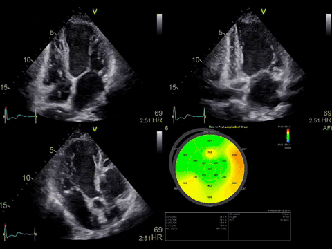 ge探头频率有哪些分享｜GE vivid E90高端心脏超声／二维心血管超声诊断系统及探头配置_https://www.jmylbn.com_新闻资讯_第8张