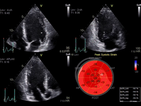 ge探头频率有哪些分享｜GE vivid E90高端心脏超声／二维心血管超声诊断系统及探头配置_https://www.jmylbn.com_新闻资讯_第7张