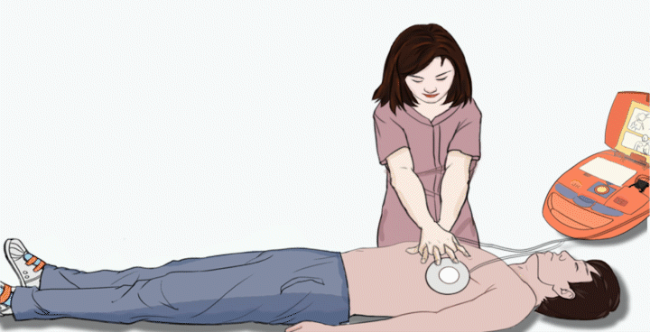 什么是aed除颤科普丨自动体外除颤器（AED）使用方法及教学_https://www.jmylbn.com_新闻资讯_第8张