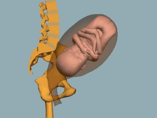 如果你不做骨盆修复，请看完这篇文章再做决定！