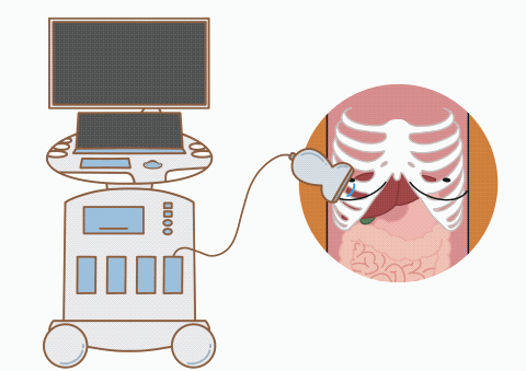 超声中什么黑什么白超声科普｜ 什么是B超_https://www.jmylbn.com_新闻资讯_第9张
