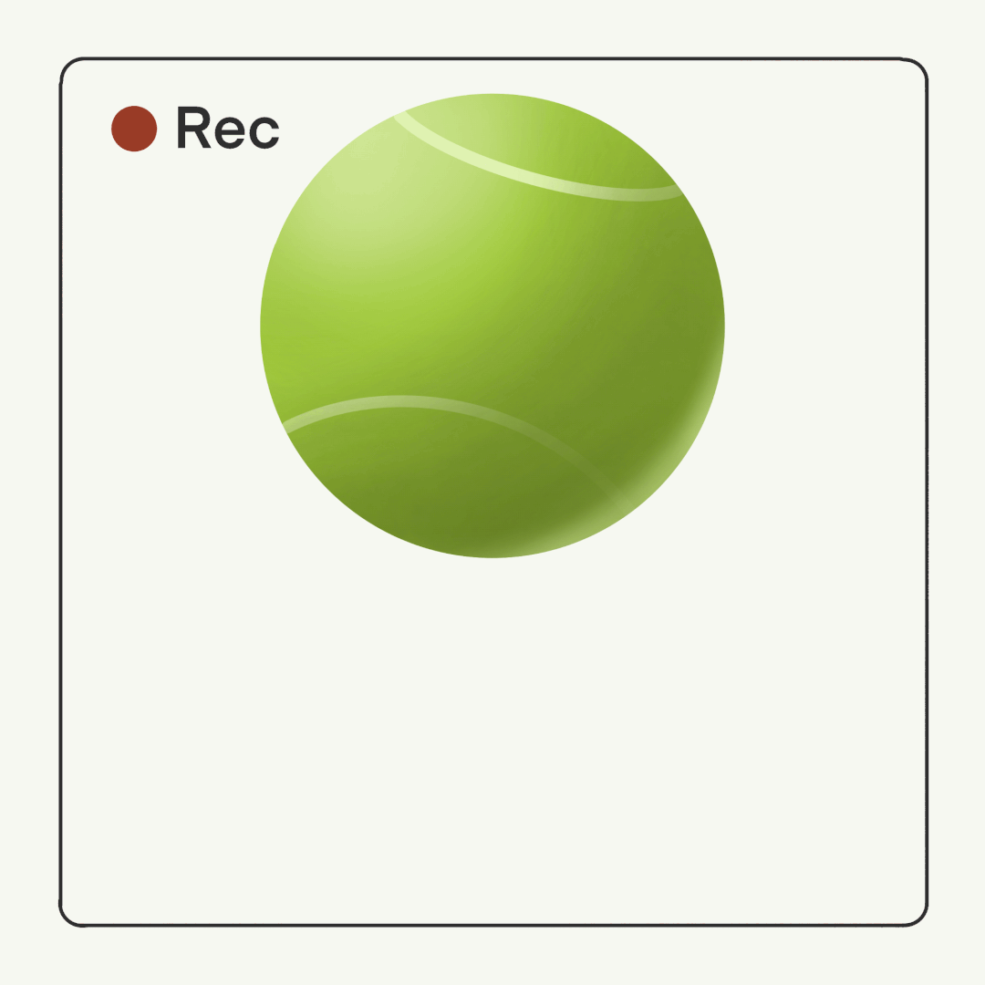 超声中什么黑什么白超声科普｜ 什么是B超_https://www.jmylbn.com_新闻资讯_第25张