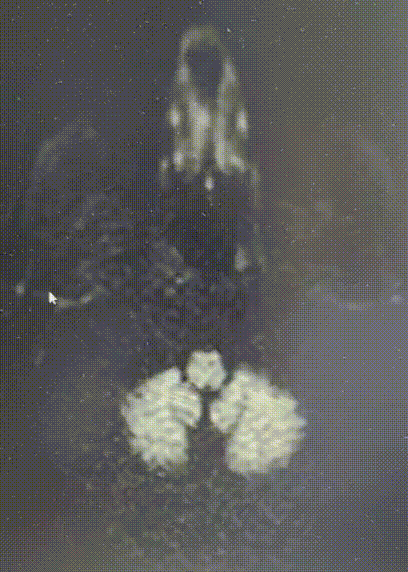 什么叫桡鞘畅疗·第十五期｜畅医达 5F 0.072