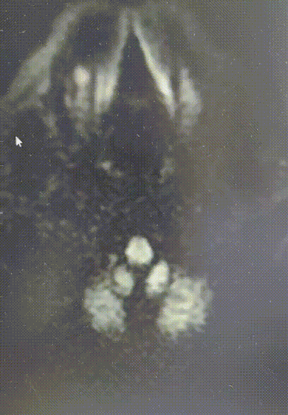 什么叫桡鞘畅疗·第十五期｜畅医达 5F 0.072