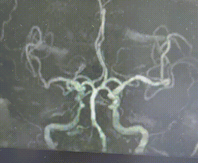 什么叫桡鞘畅疗·第十五期｜畅医达 5F 0.072