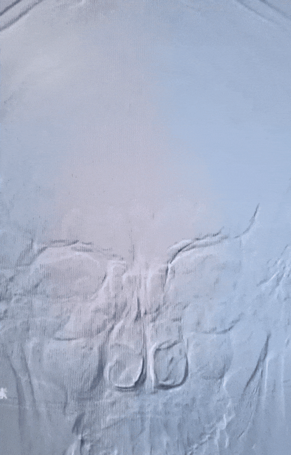 动脉长鞘怎么置入有励可说｜Locaste 088励楷长鞘在右侧颈内动脉闭塞并夹层术中的应用_https://www.jmylbn.com_新闻资讯_第8张