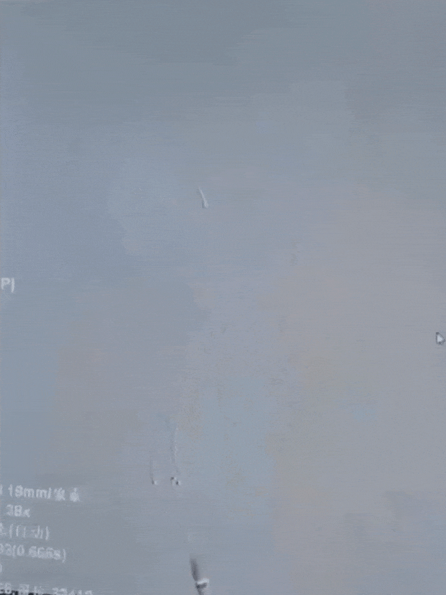 动脉长鞘怎么置入有励可说｜Locaste 088励楷长鞘在右侧颈内动脉闭塞并夹层术中的应用_https://www.jmylbn.com_新闻资讯_第17张