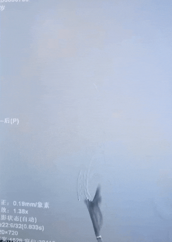 动脉长鞘怎么置入有励可说｜Locaste 088励楷长鞘在右侧颈内动脉闭塞并夹层术中的应用_https://www.jmylbn.com_新闻资讯_第15张