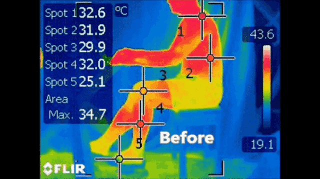 什么红外线理疗好远红外线“温热理疗法” 从内而外排寒效果棒_https://www.jmylbn.com_新闻资讯_第2张