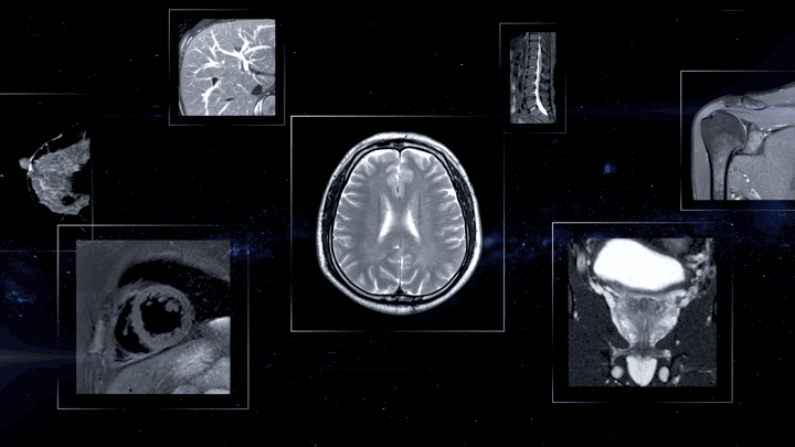 联影磁共振怎么样【三级医院创建 • 技术装备提升】再添医学影像“利器”——我院引进联影uMR870  3.0T磁共振_https://www.jmylbn.com_新闻资讯_第14张