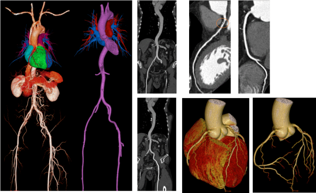 医用ct胶片怎么收纳医用彩色胶片：让影像诊断更精准的“全彩视界”_https://www.jmylbn.com_新闻资讯_第9张