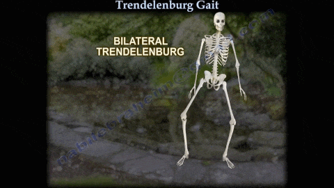 步态分析上曲线怎么解读步态分析的常用方法，很实用！_https://www.jmylbn.com_新闻资讯_第10张