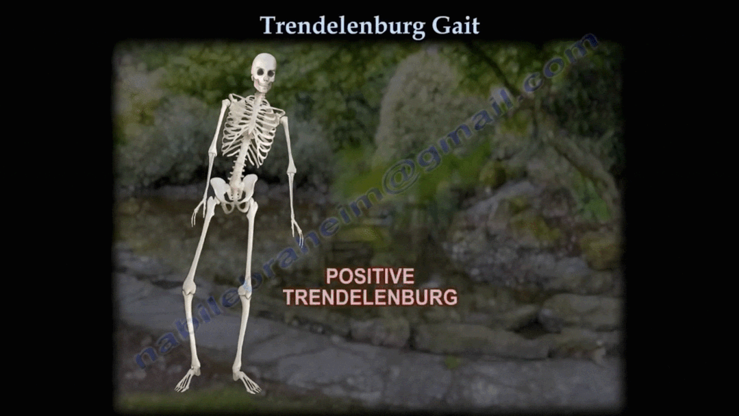 步态分析上曲线怎么解读步态分析的常用方法，很实用！_https://www.jmylbn.com_新闻资讯_第9张