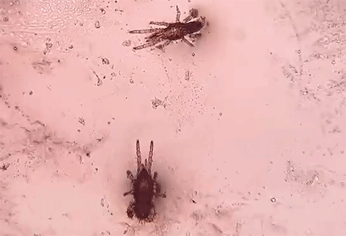 孕妇闻了半小时风油精味道_风油精孕妇闻了对胎儿有影响吗_孕妇风油精闻一个小时没事吧