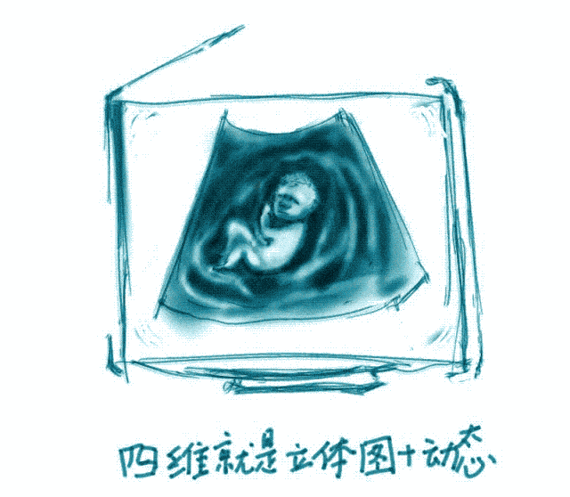 美国彩超怎么购买彩超界的网红—— 美国GE-E10四维彩超，你了解多少_https://www.jmylbn.com_新闻资讯_第5张