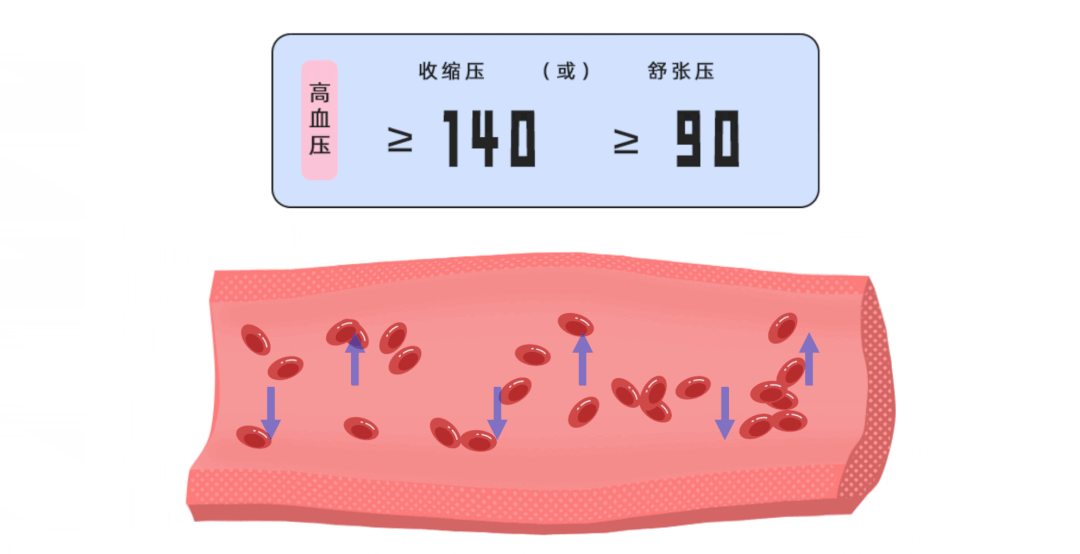 动态血压仪怎么安装24小时动态血压仪安装的注意事项_https://www.jmylbn.com_新闻资讯_第3张