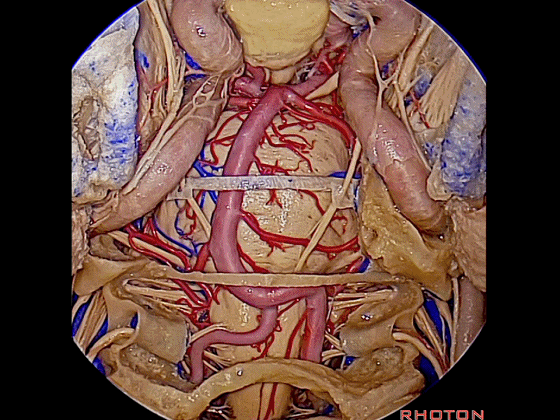 外展枕怎么使用脑干解剖及相关入路---Rhoton解剖视频学习笔记系列_https://www.jmylbn.com_新闻资讯_第358张
