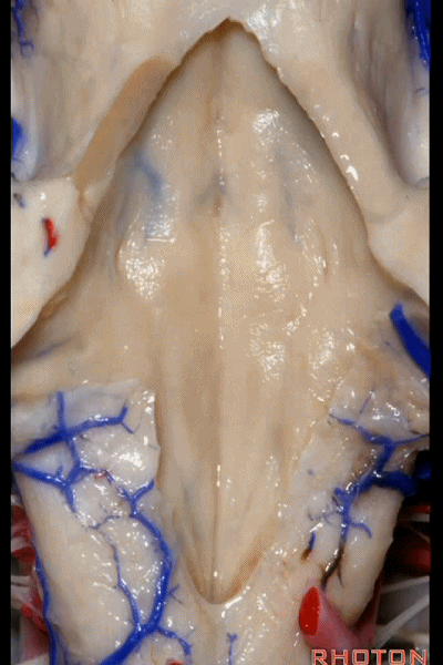 外展枕怎么使用脑干解剖及相关入路---Rhoton解剖视频学习笔记系列_https://www.jmylbn.com_新闻资讯_第261张