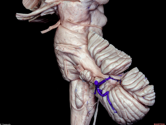 外展枕怎么使用脑干解剖及相关入路---Rhoton解剖视频学习笔记系列_https://www.jmylbn.com_新闻资讯_第35张