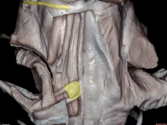 外展枕怎么使用脑干解剖及相关入路---Rhoton解剖视频学习笔记系列_https://www.jmylbn.com_新闻资讯_第123张