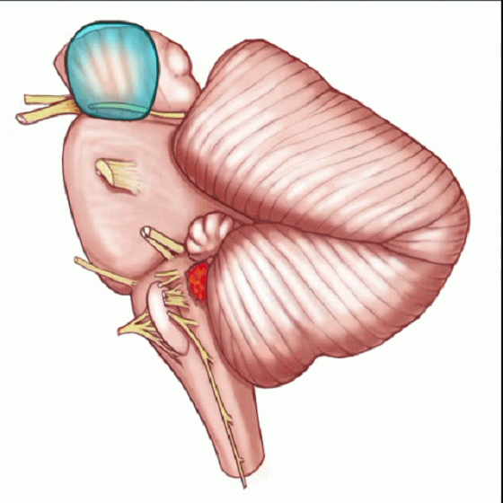 外展枕怎么使用脑干解剖及相关入路---Rhoton解剖视频学习笔记系列_https://www.jmylbn.com_新闻资讯_第169张