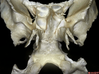 外展枕怎么使用脑干解剖及相关入路---Rhoton解剖视频学习笔记系列_https://www.jmylbn.com_新闻资讯_第330张